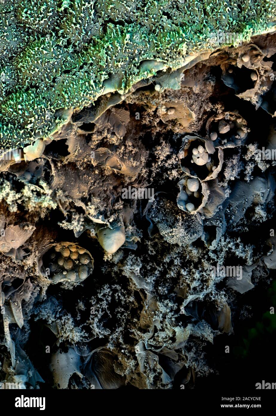 Broccoli. Coloured scanning electron micrograph (SEM) of plant tissue ...