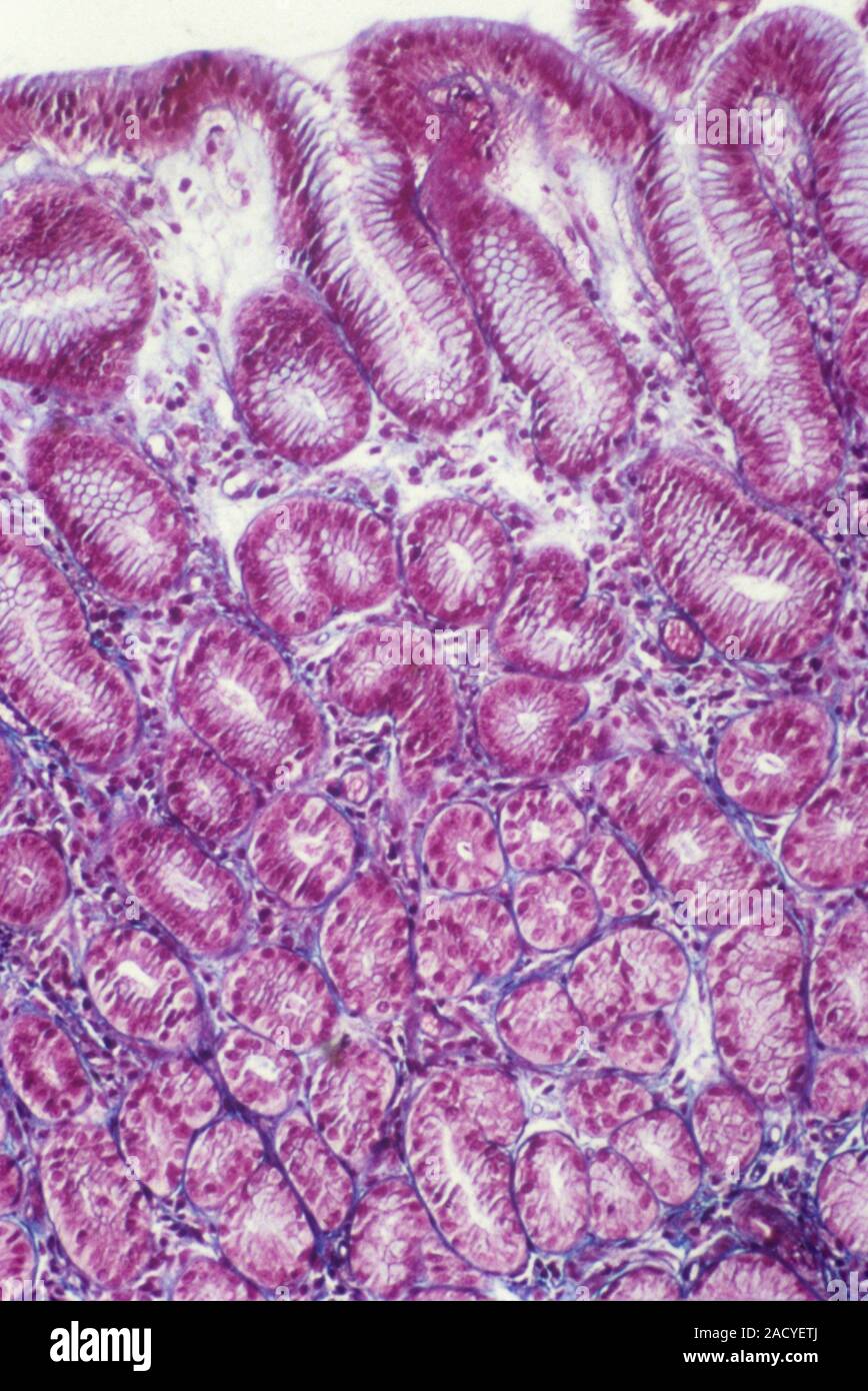 Stomach lining. Light micrograph of a section through the healthy