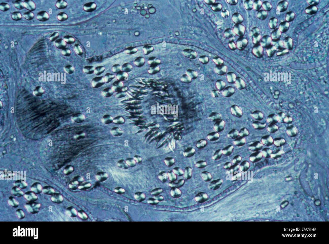 Tapeworm infested liver. Light micrograph of a section through cysts in
