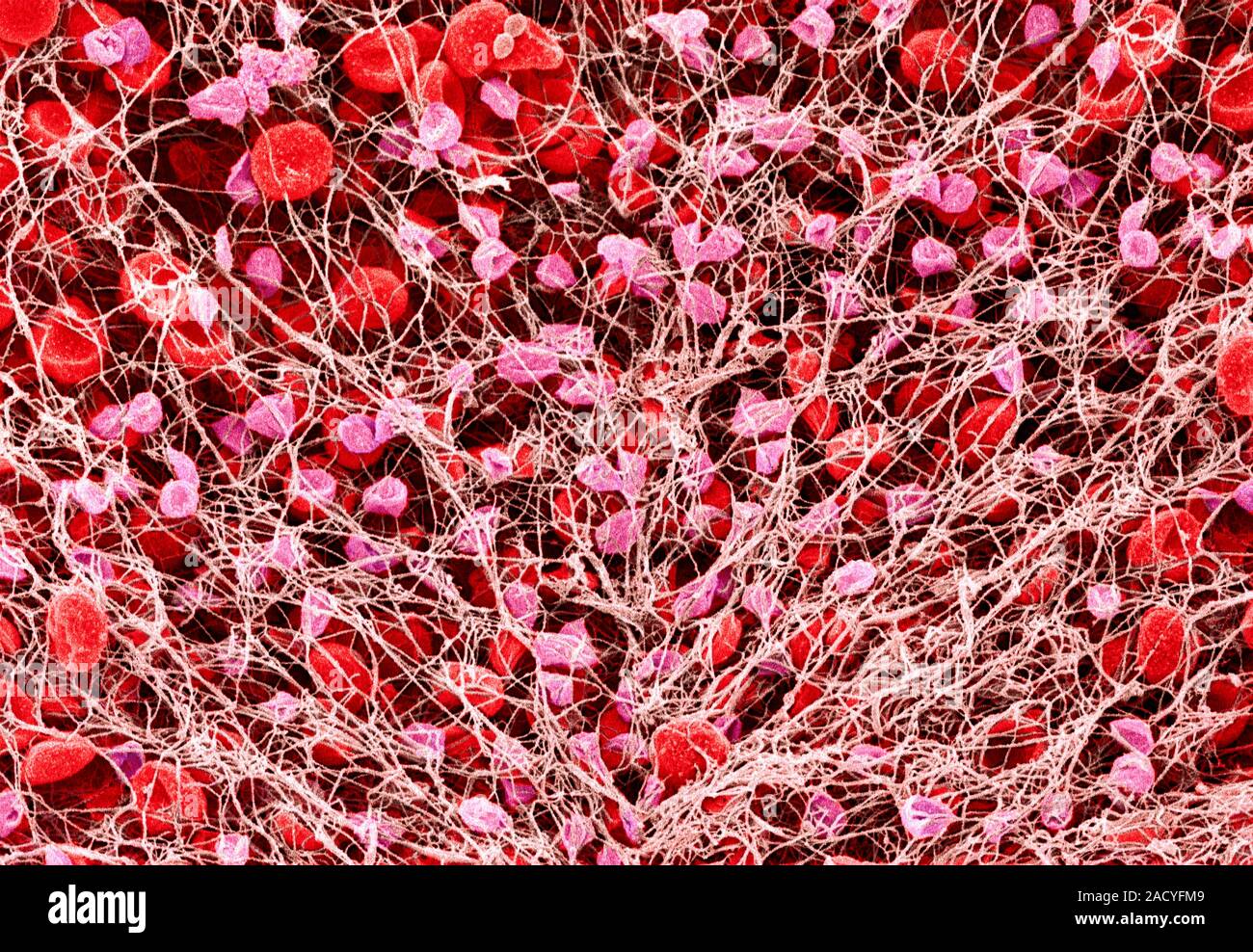 фибрин капилляры