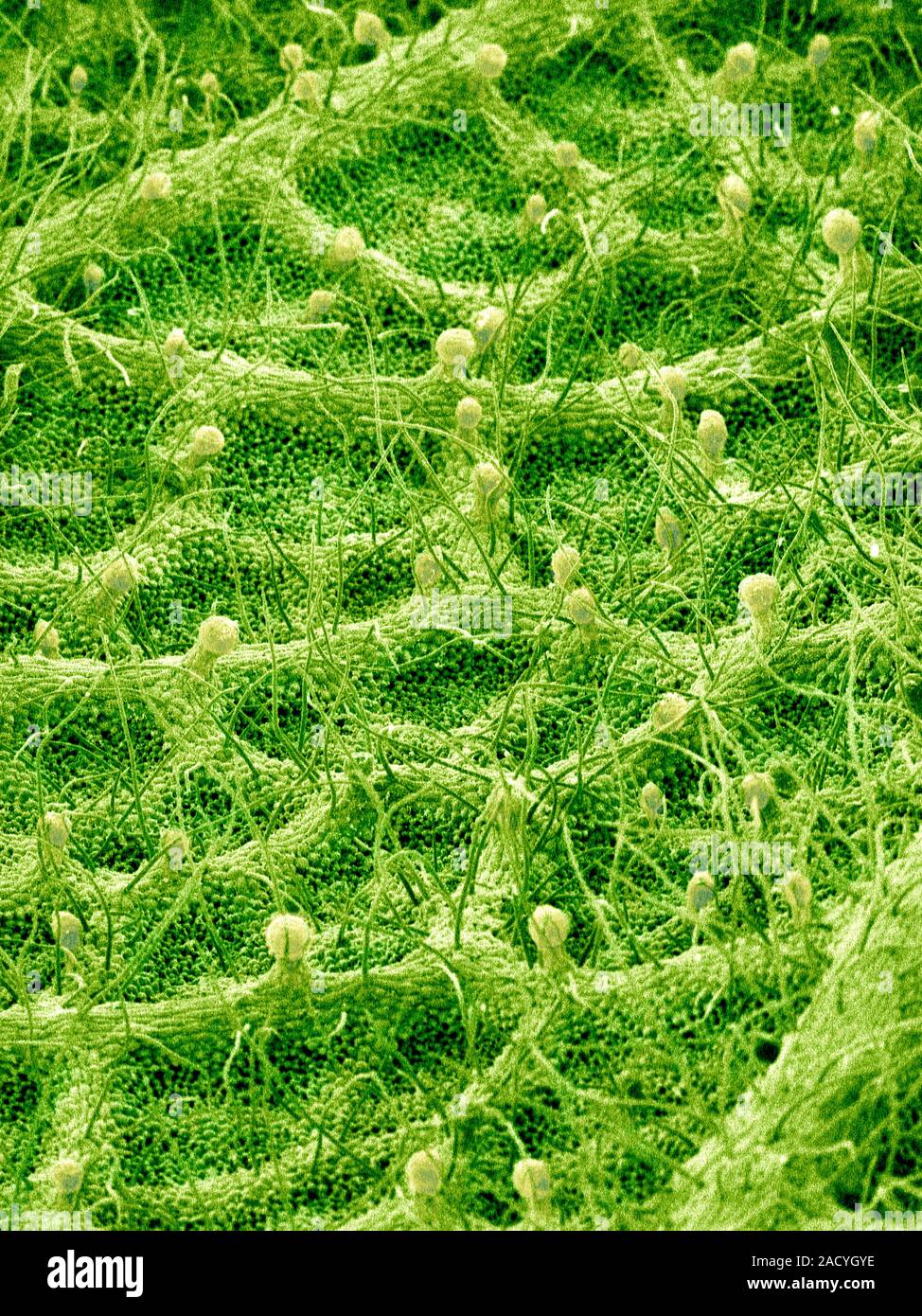 Underside of a leaf, coloured scanning electron micrograph (SEM). Hairs
