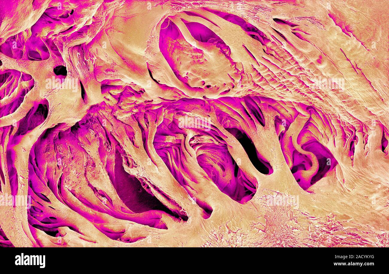 Heart muscle. Coloured scanning electron micrograph (SEM) of pectinate