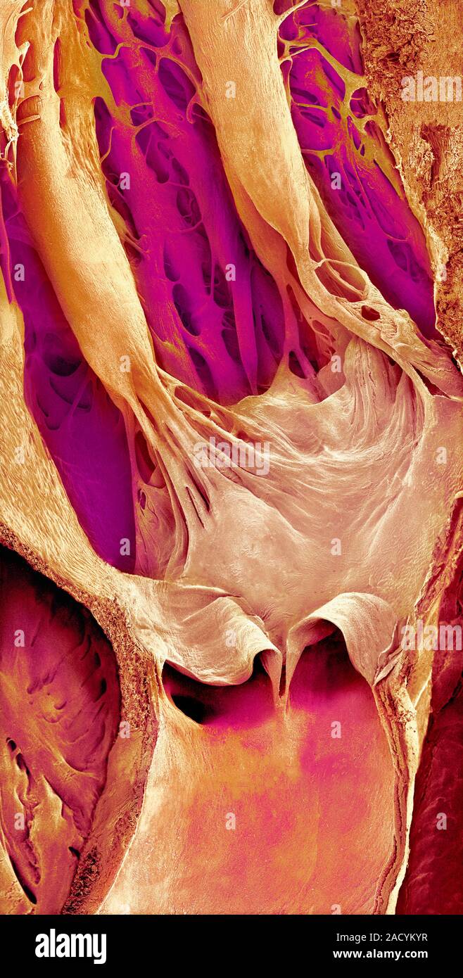 Heart valve and strings, coloured scanning electron micrograph (SEM ...