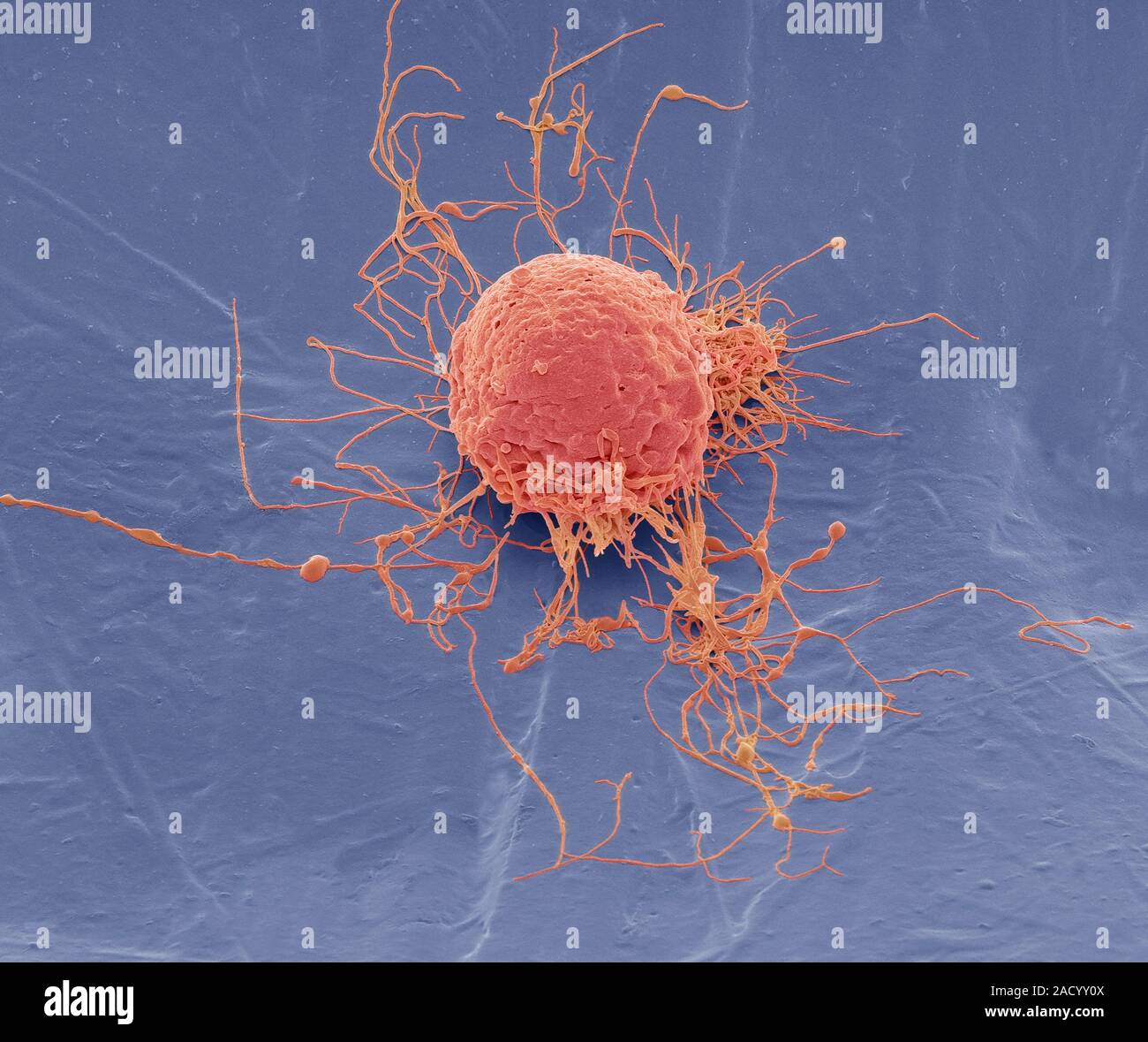 Mesenchymal stem cell. Coloured scanning electron micrograph (SEM) of a