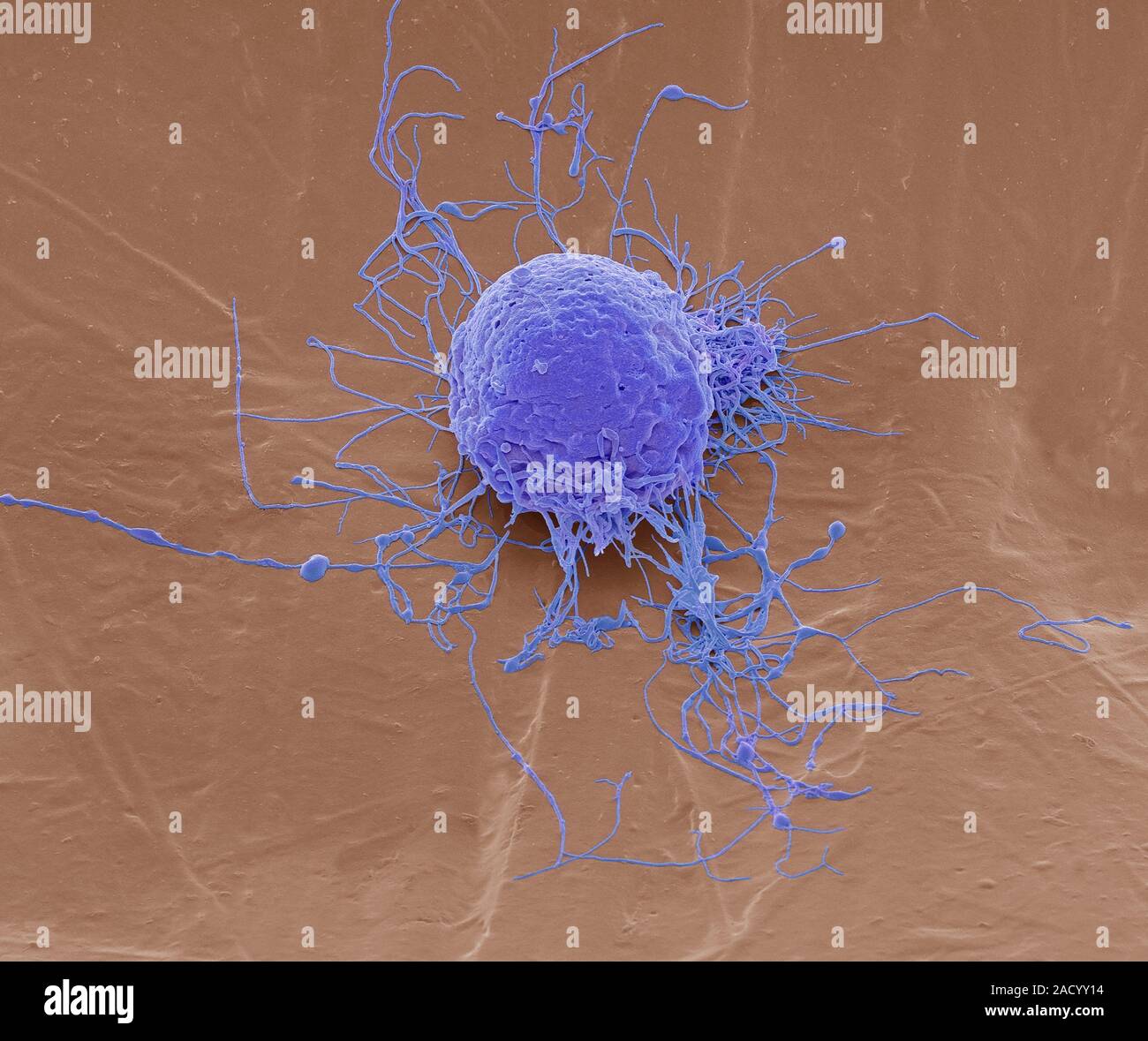 Mesenchymal stem cell. Coloured scanning electron micrograph (SEM) of a