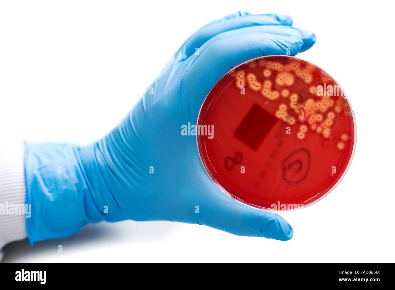 Cultured Streptococcus bacteria. Haemolytic Streptococcus sp