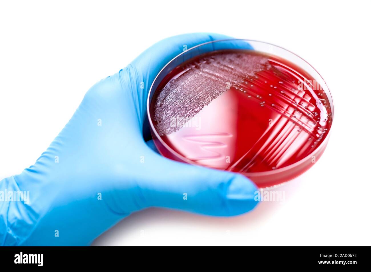 Cultured Streptococcus bacteria. Haemolytic Streptococcus pneumoniae
