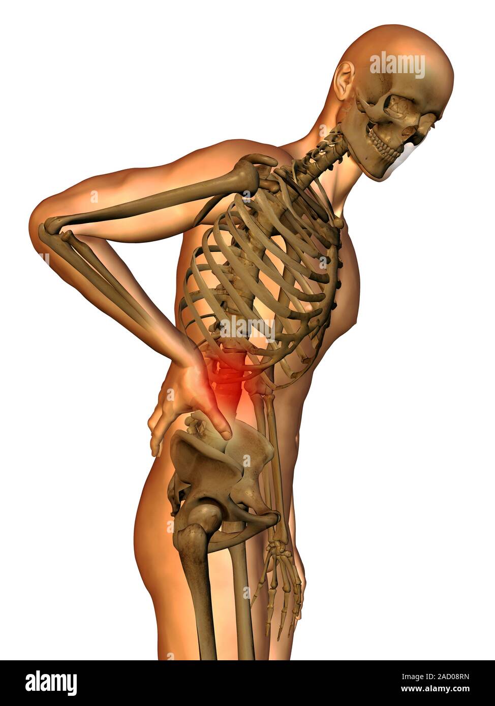 Human back pain, computer illustration Stock Photo - Alamy
