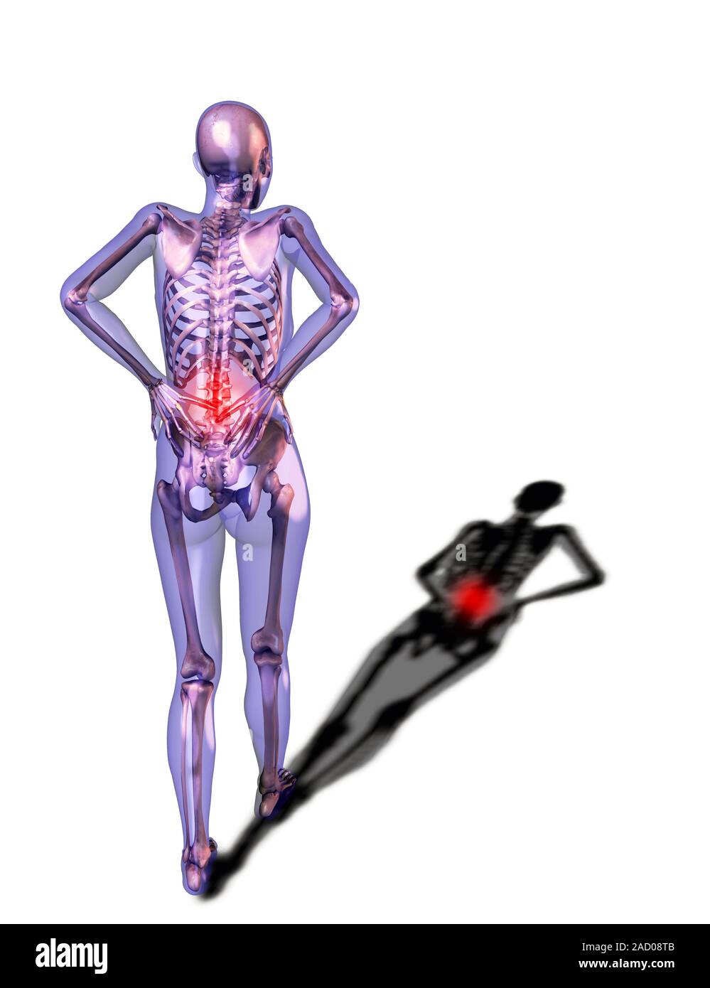 Human back pain, computer illustration Stock Photo - Alamy