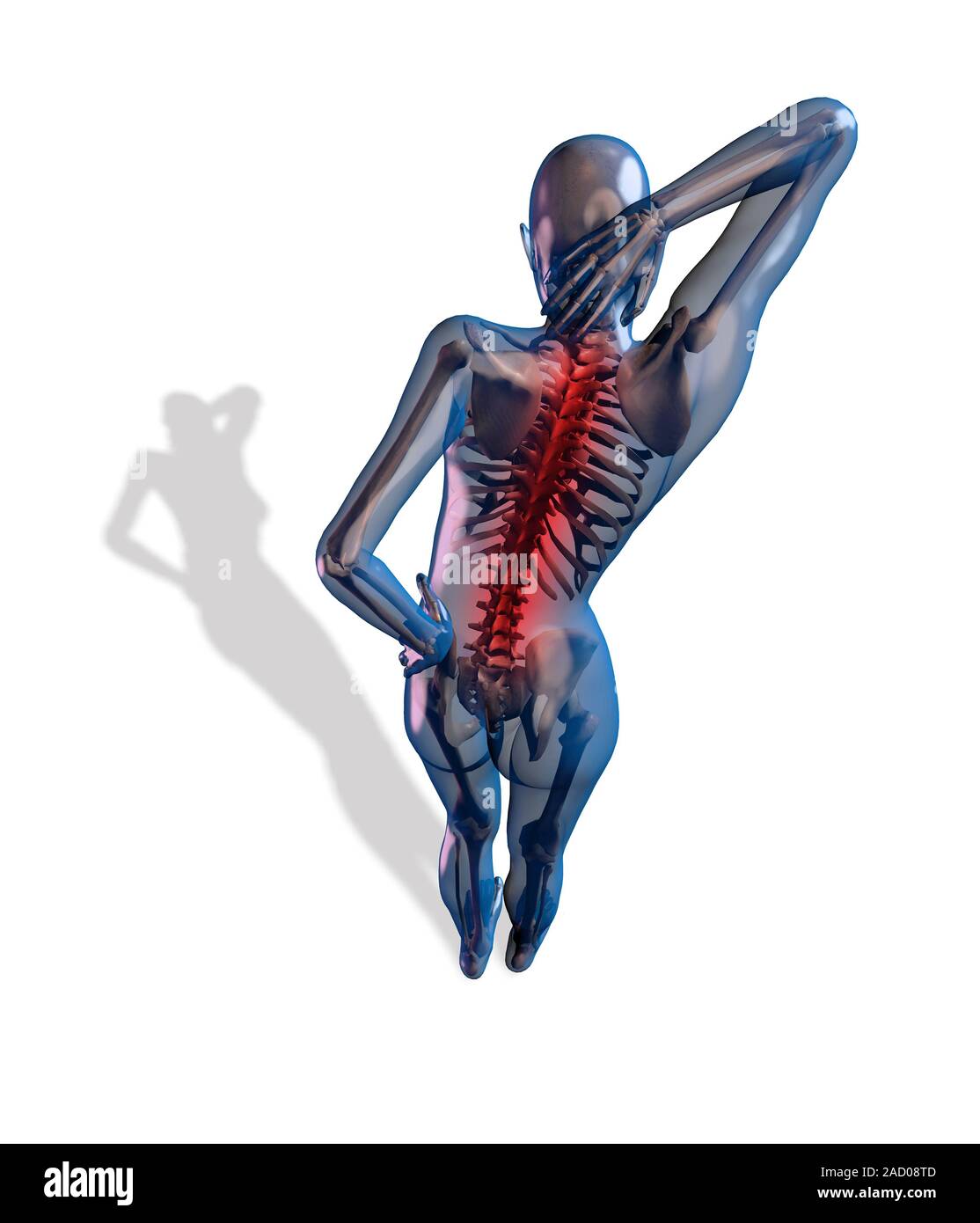 Human back pain, computer illustration Stock Photo - Alamy