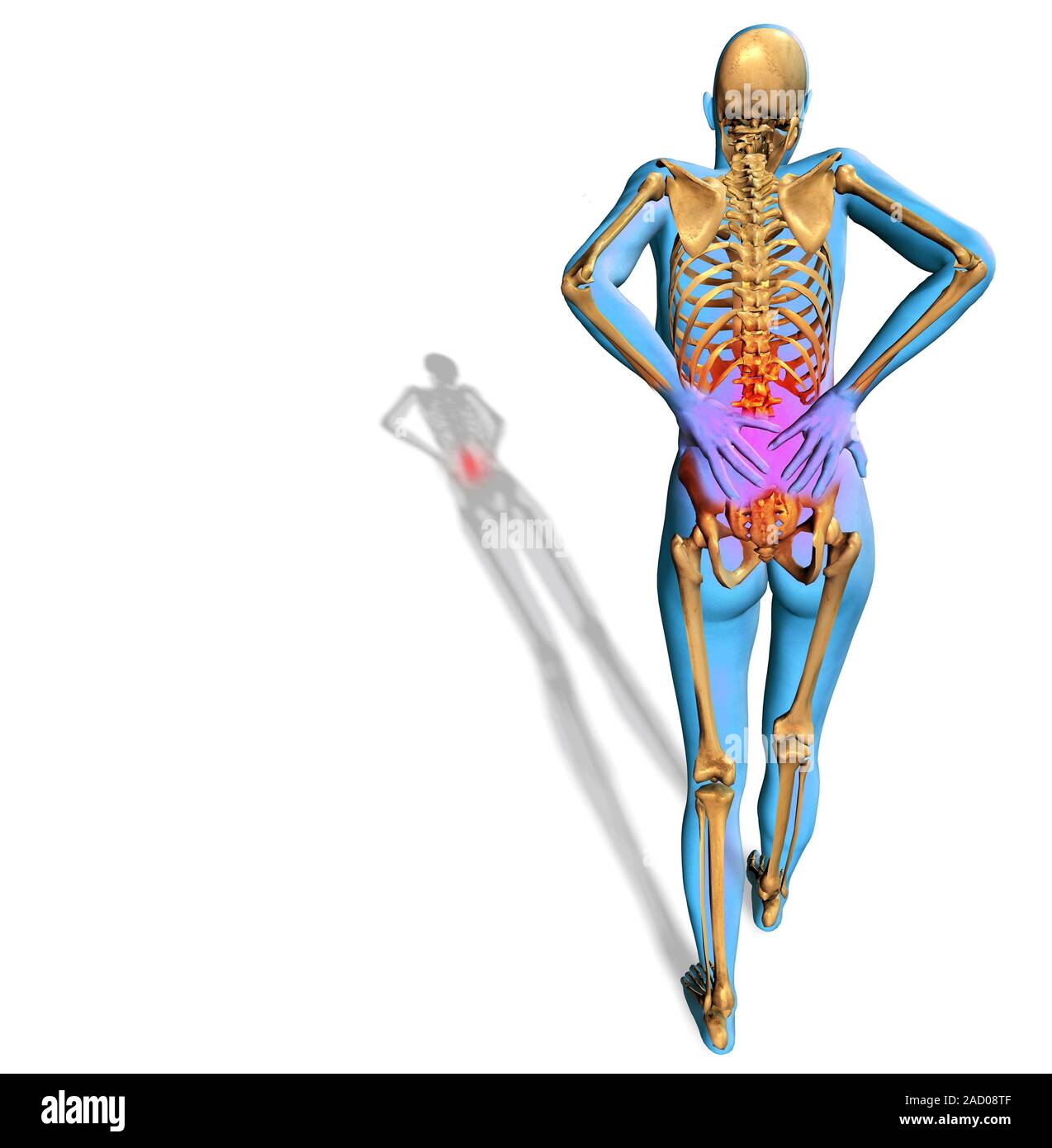Human back pain, computer illustration Stock Photo - Alamy