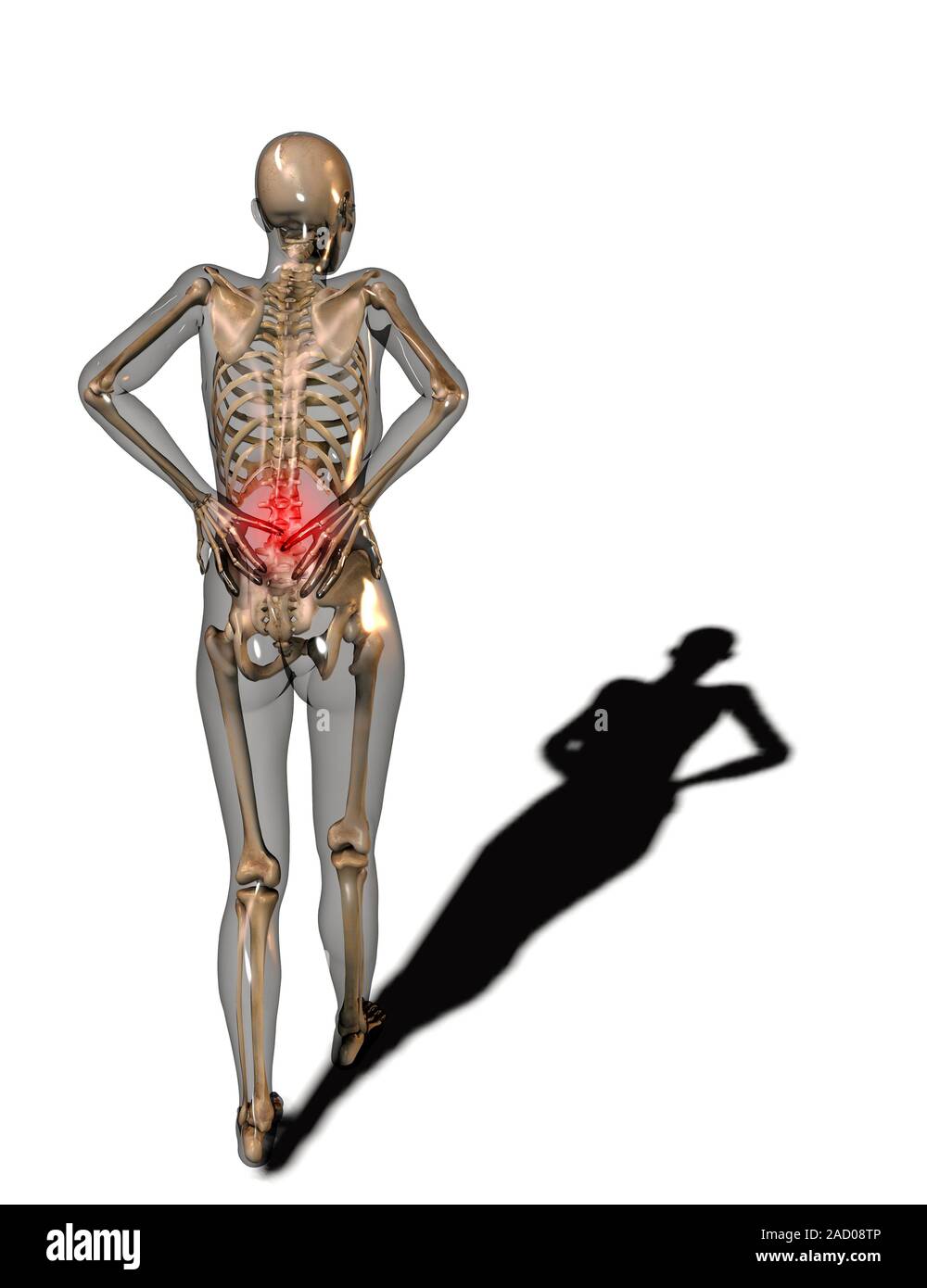 Human back pain, computer illustration Stock Photo - Alamy