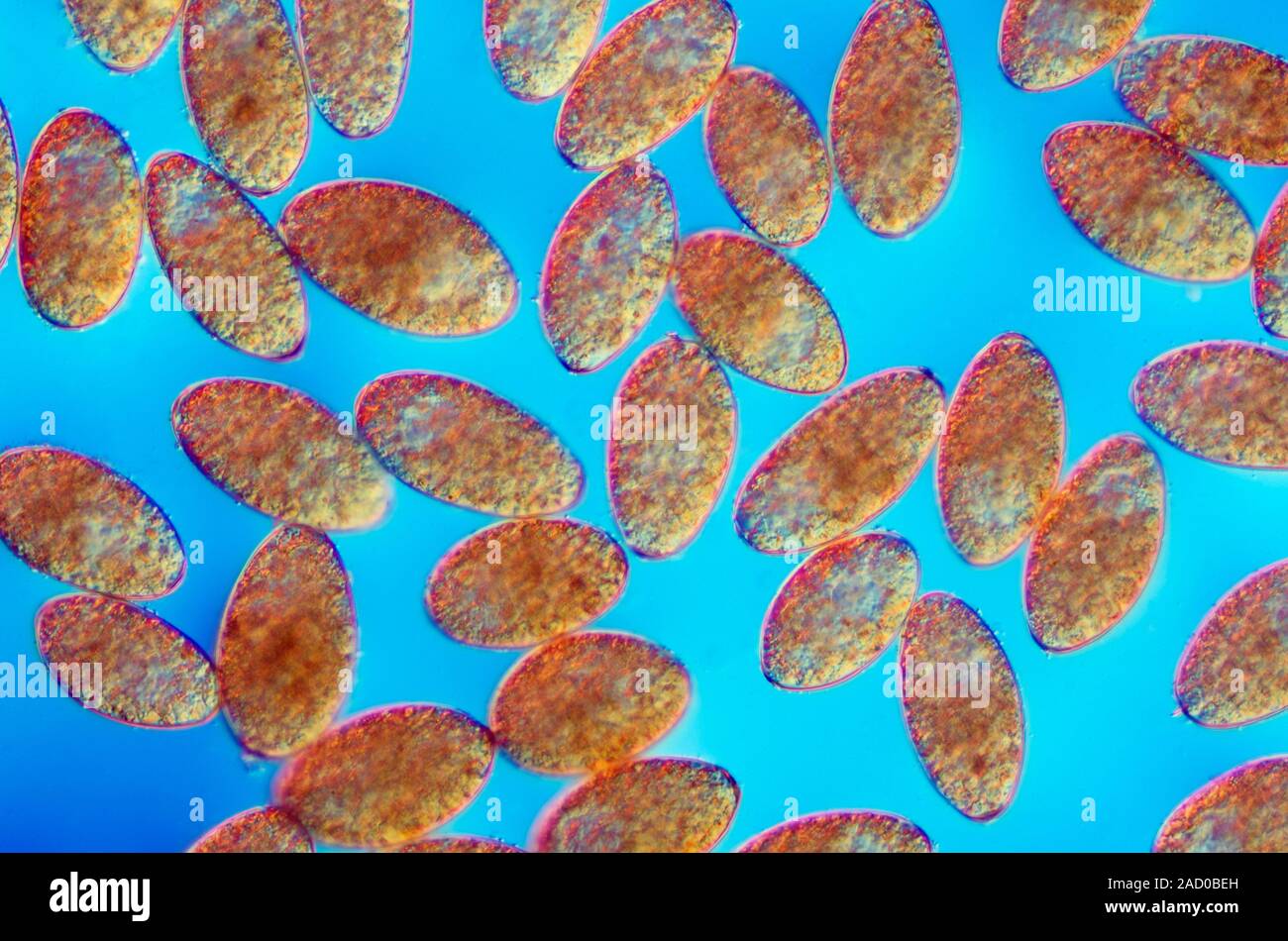 The eggs of Fasciola hepatica ( Linnaeus 1758 ) or The Common Liver
