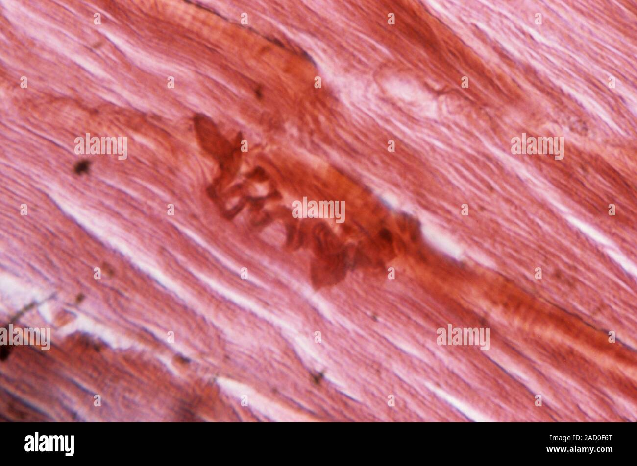 Muscle in Cushing's syndrome. Light micrograph of a section through