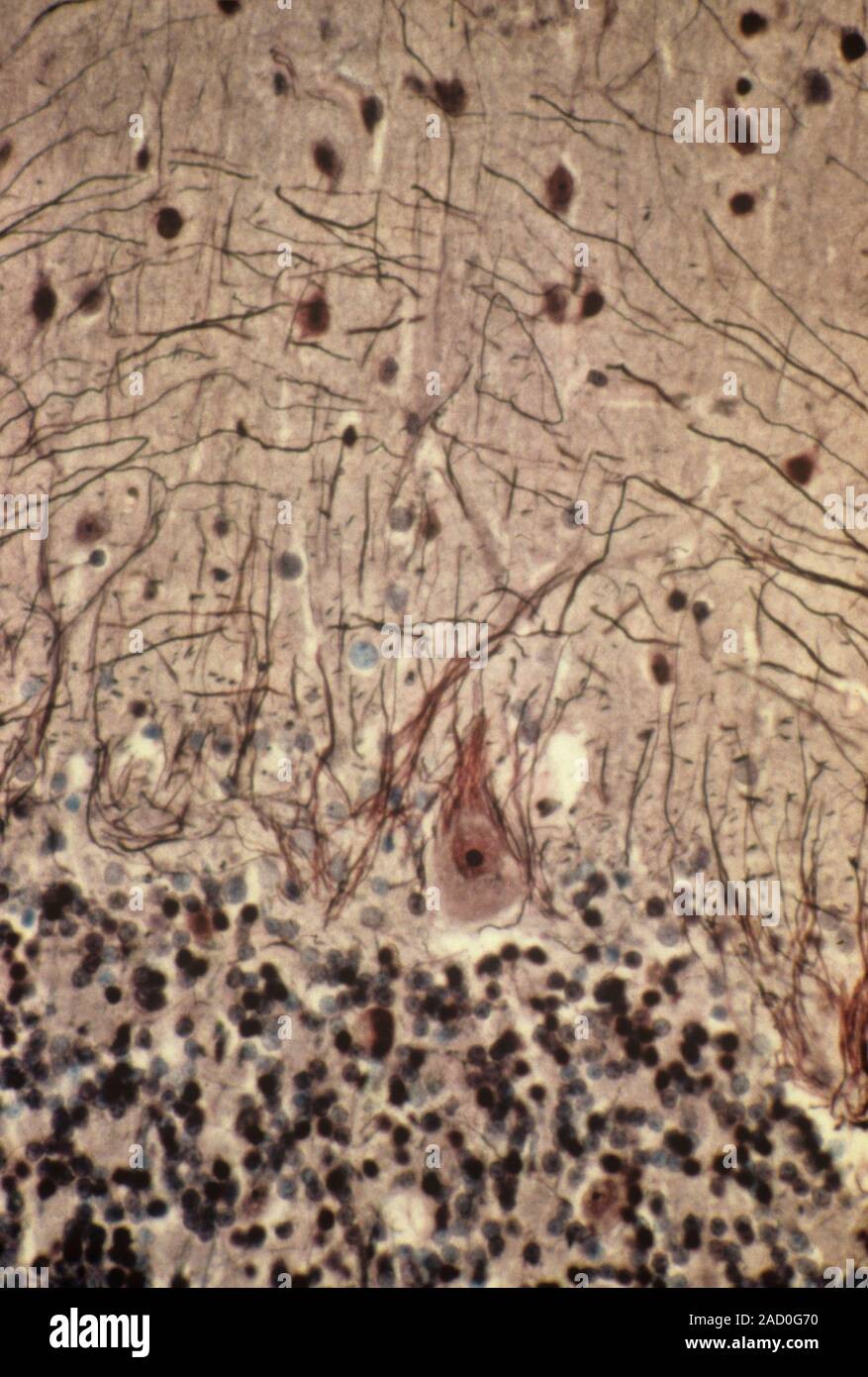 Purkinje nerve cells. Light micrograph of a row of Purkinje nerve cells ...