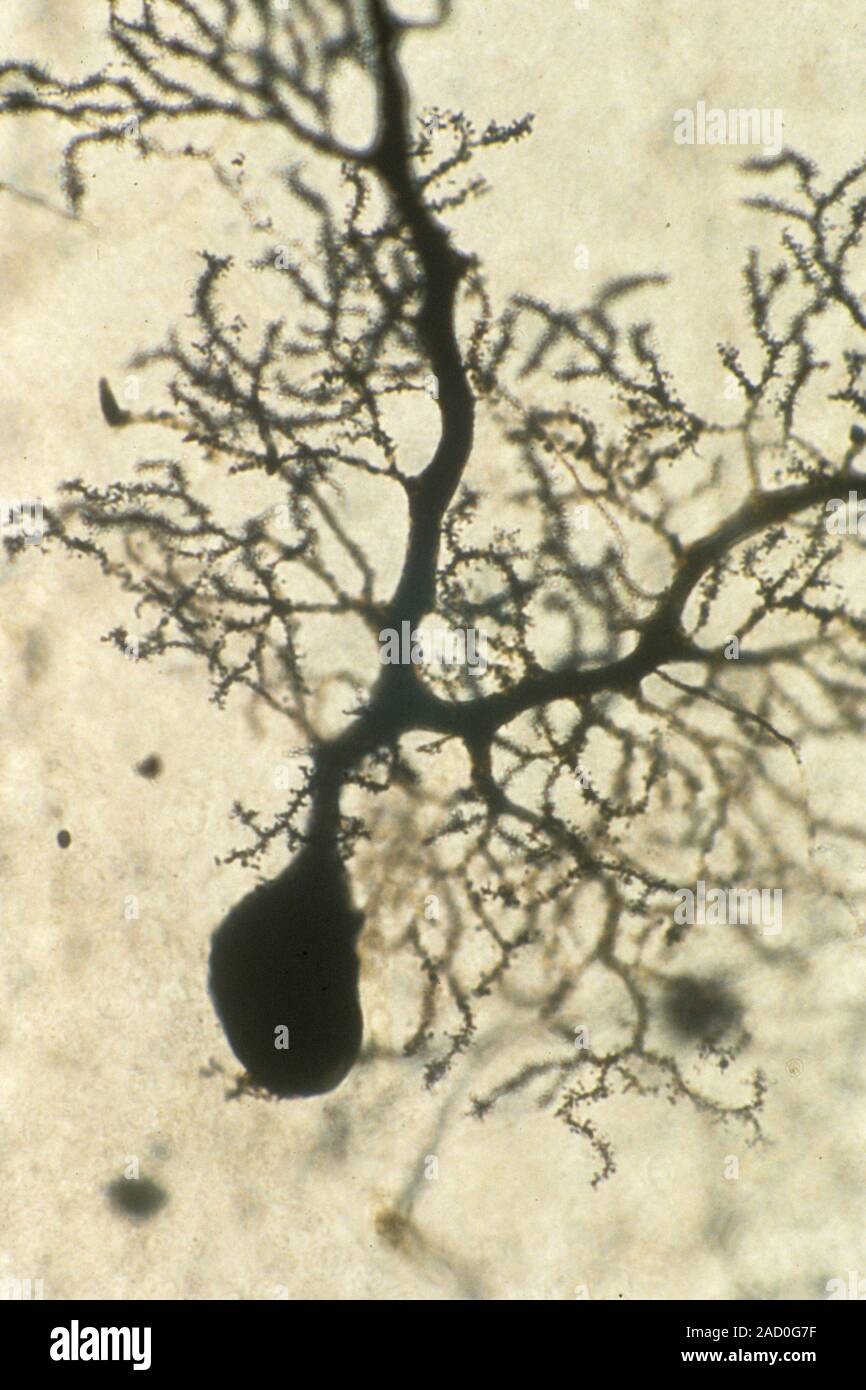 Purkinje nerve cell. Light micrograph of a Purkinje nerve cell from the ...