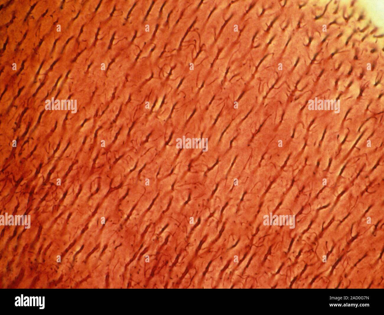 Dentine. Light micrograph of a section through dentine (or dentin) from
