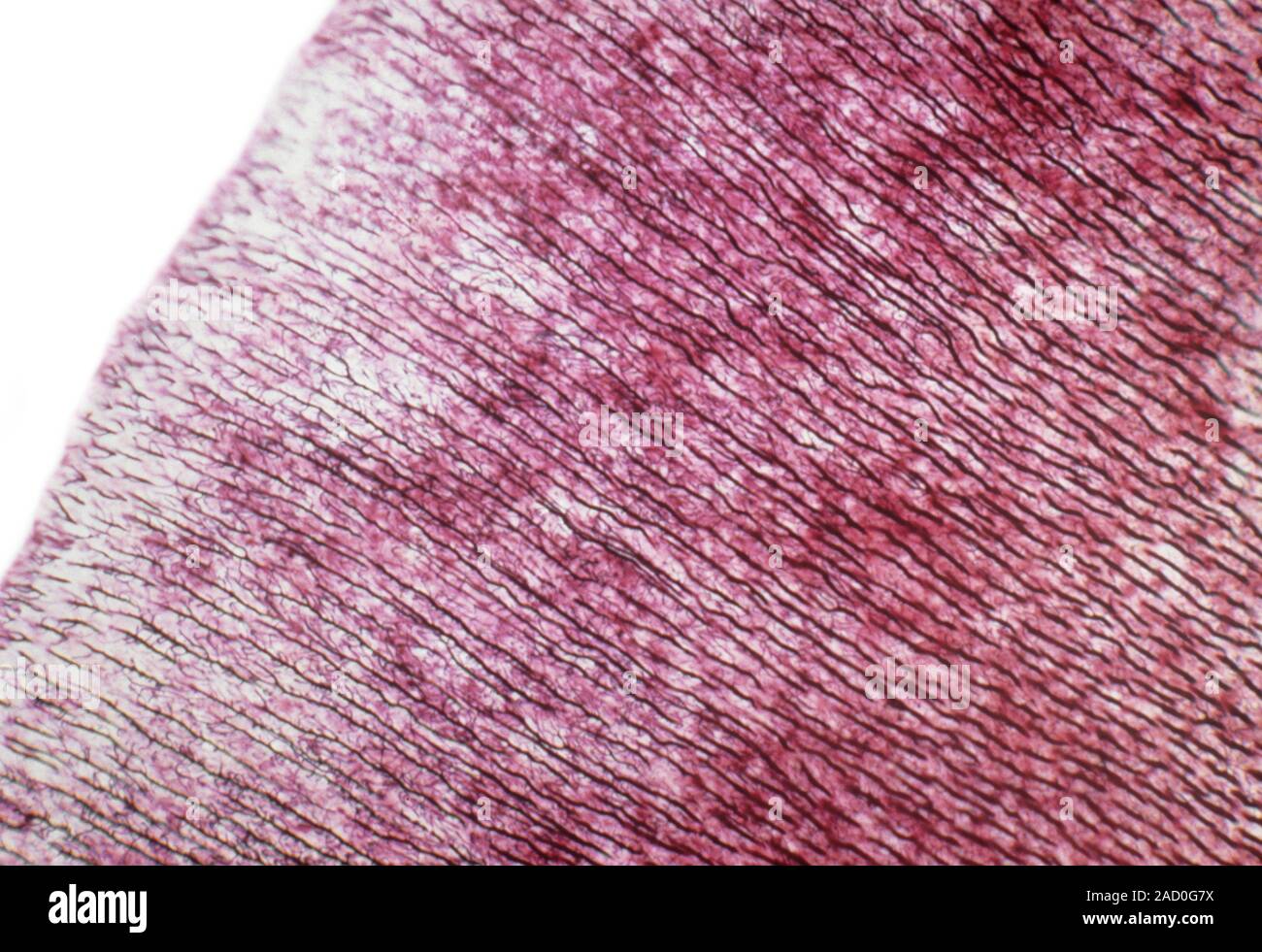 Dentine. Light micrograph of a section through dentine (or dentin) from