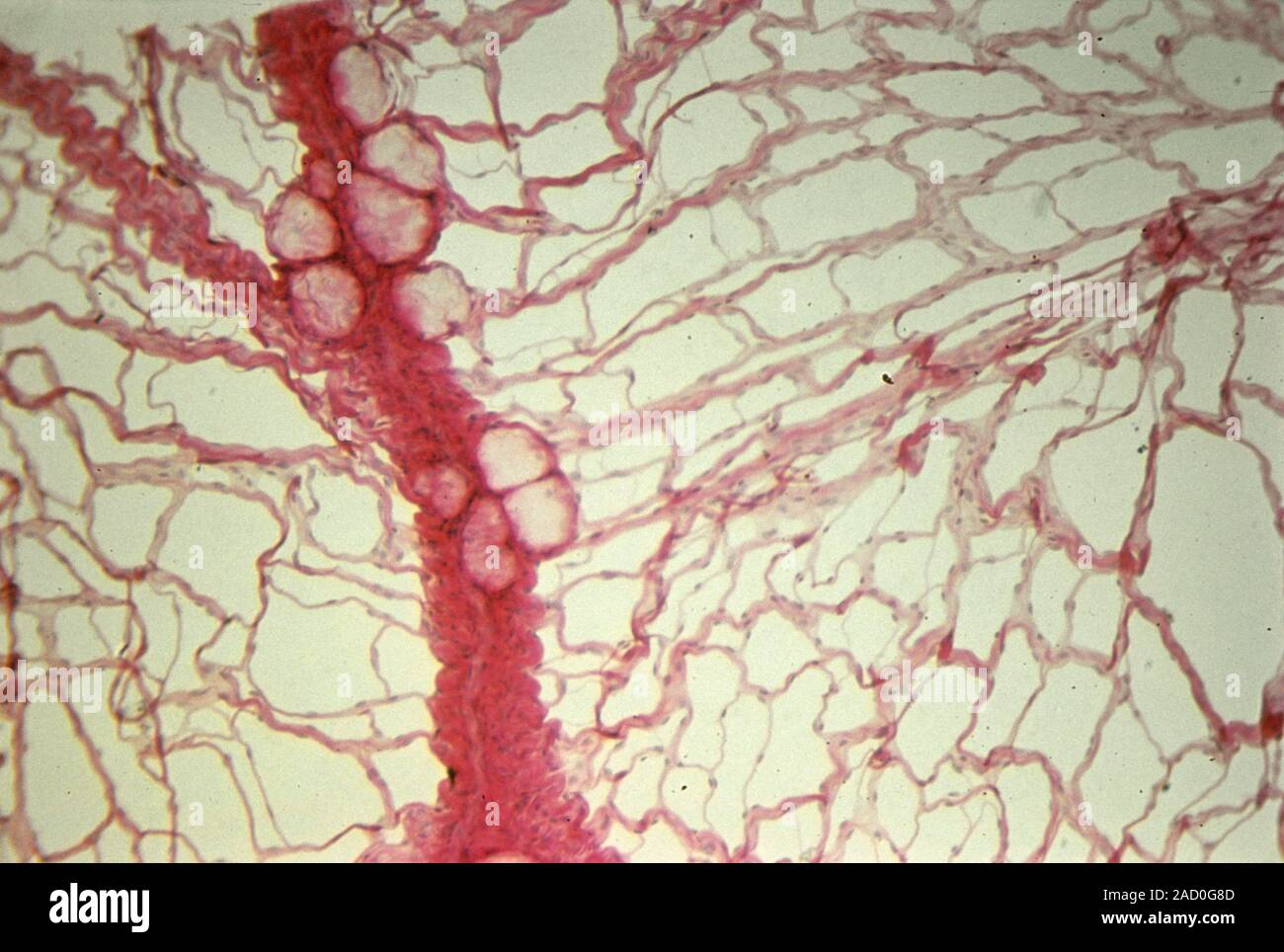 Peritoneal blood vessels, light micrograph. The peritoneum is the ...