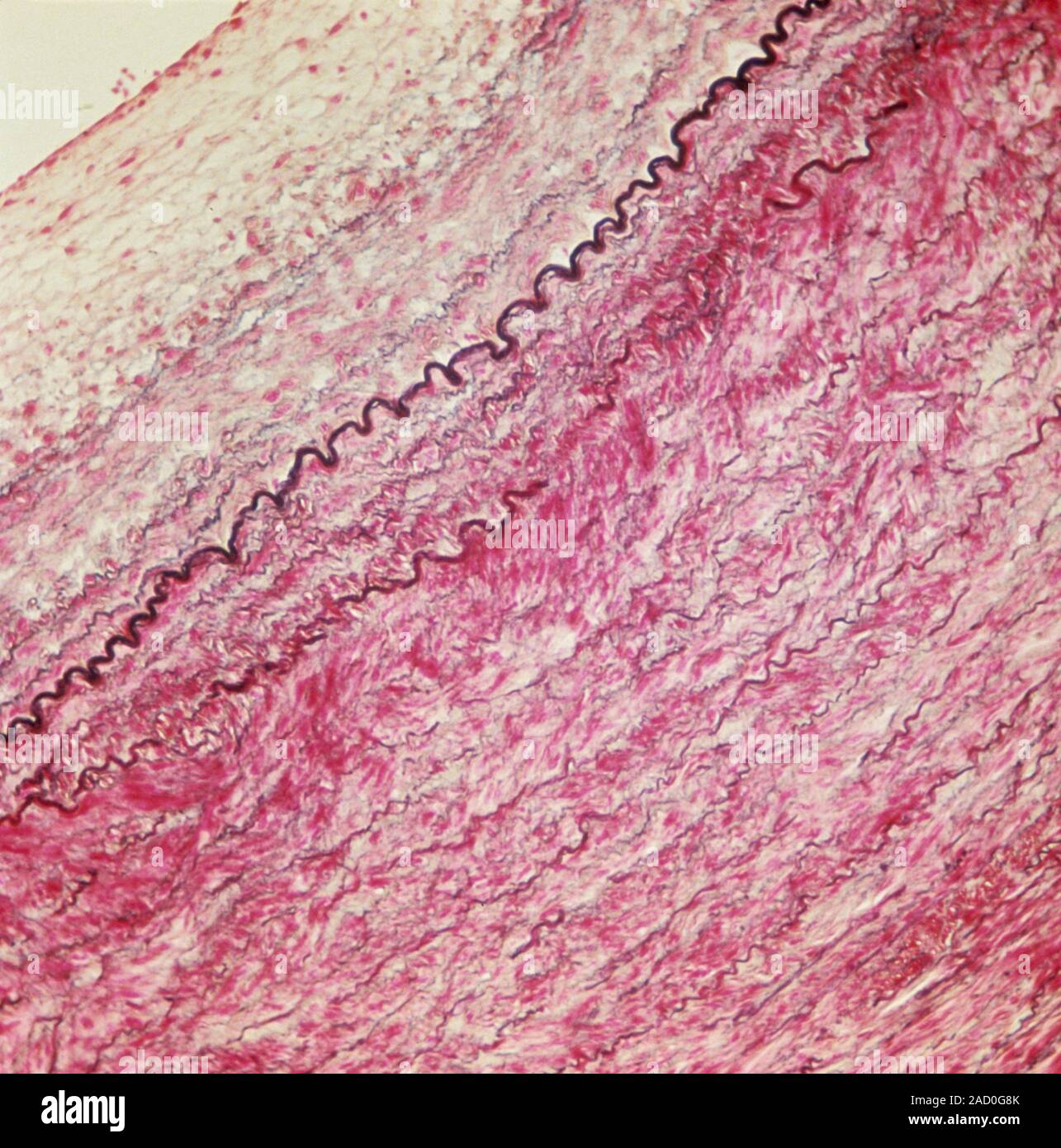 Elastic artery wall. Light micrograph of a section through part of the
