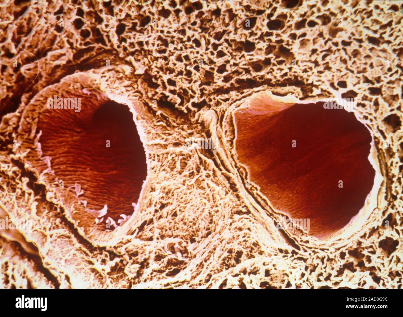 Pulmonary vein and artery. Coloured scanning electron microscope (SEM