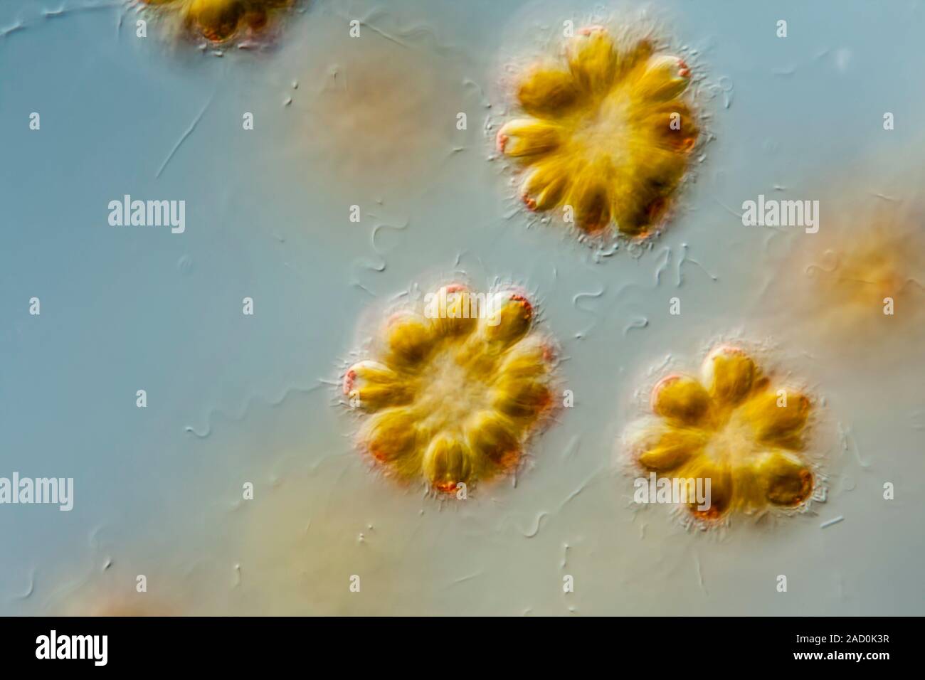 Synura sphagnicola, Chrysophytes or Golden Algae, common in Spahgnum