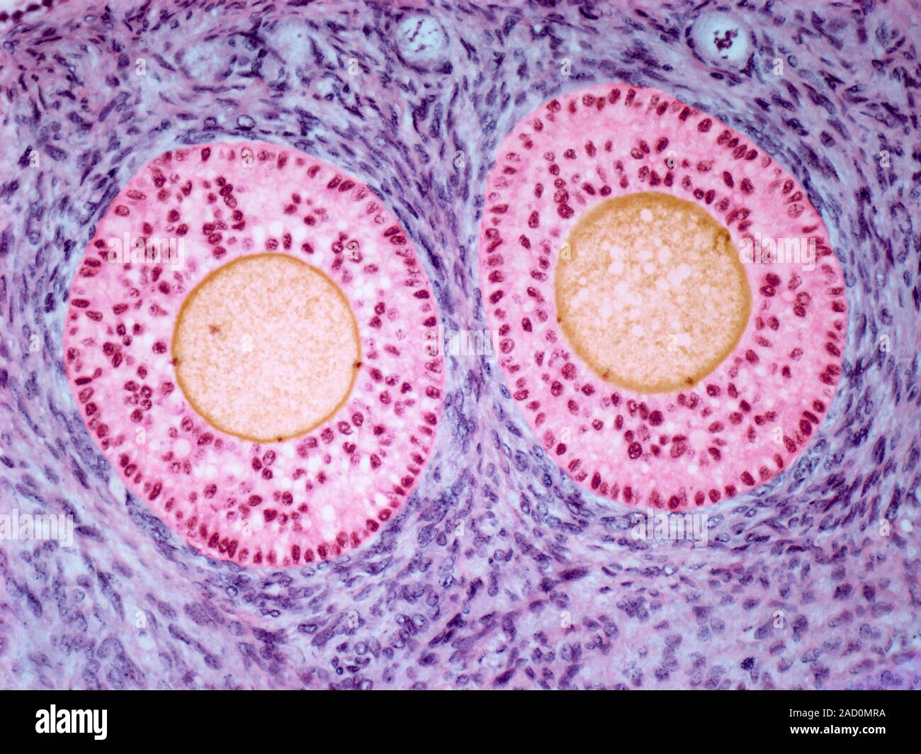 Ovarian follicles. Light micrograph of a section through late primary ...