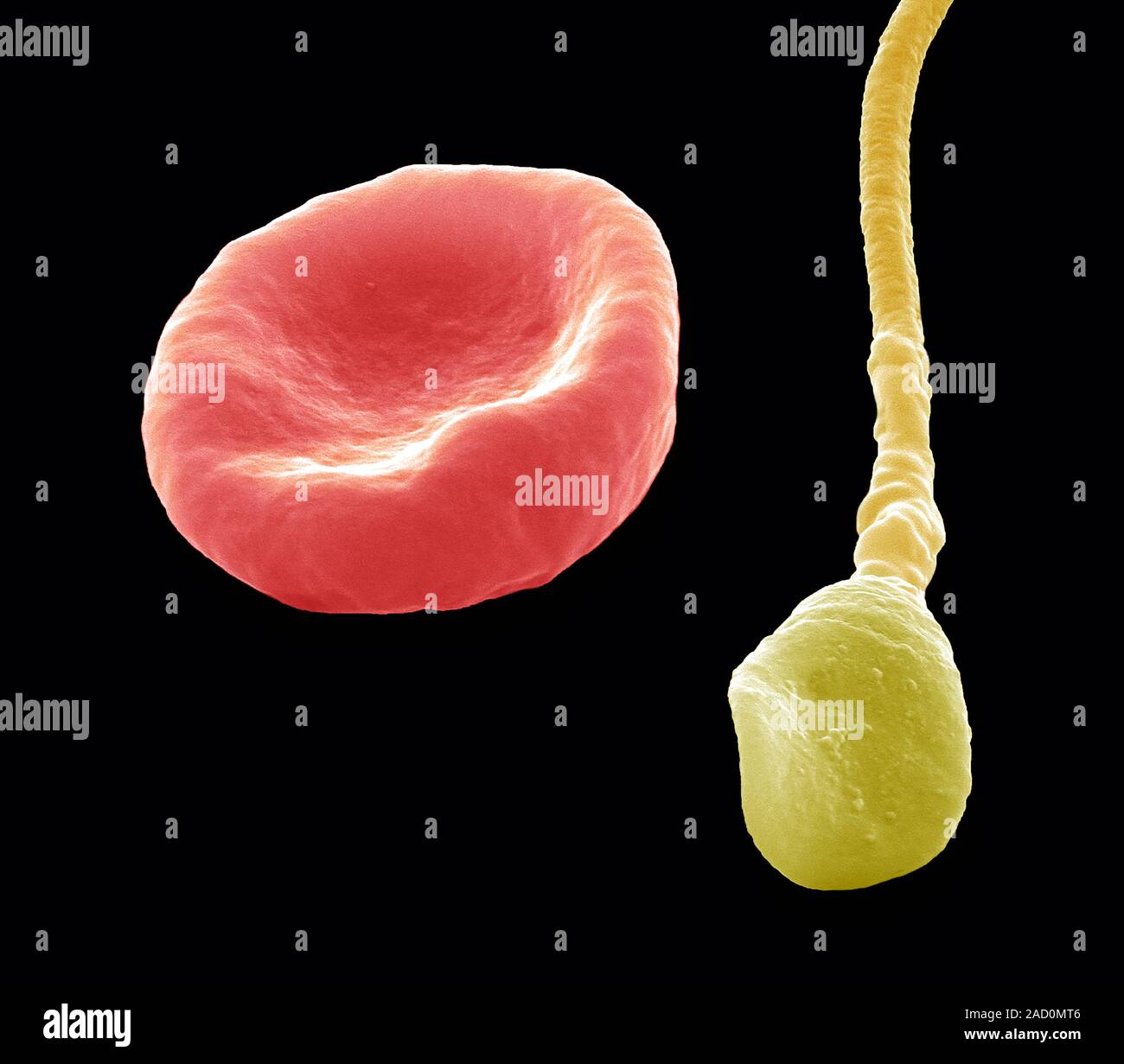 Red blood cell and spem. Coloured scanning electron micrograph (SEM