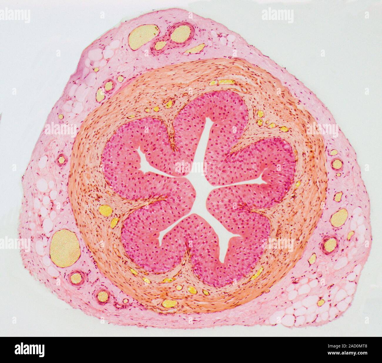 Ureter. Light micrograph( LM) of a section through an entire ureter. The ureter is the tube that