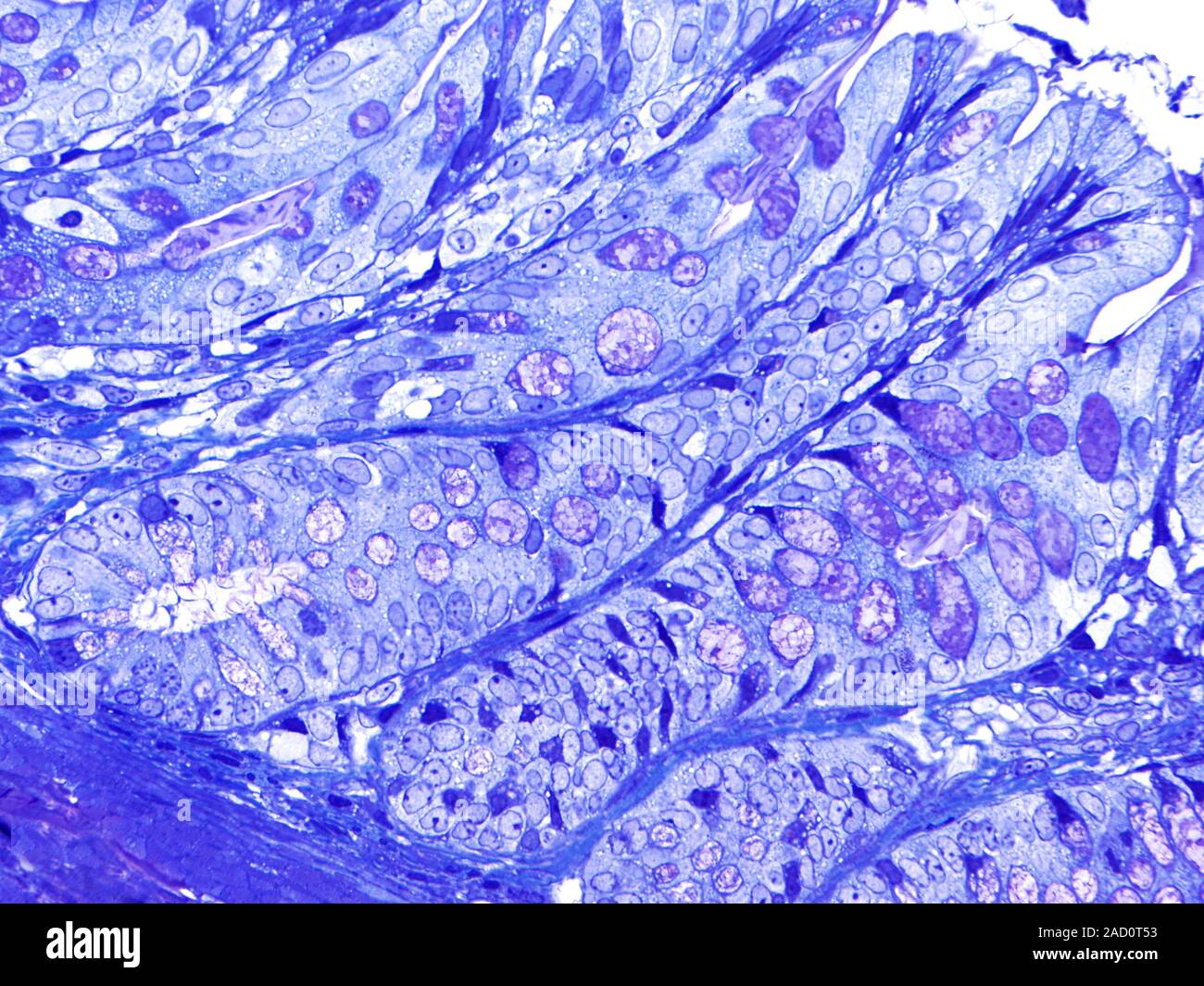 Light microscopy of large bowel glands showing many goblet cells