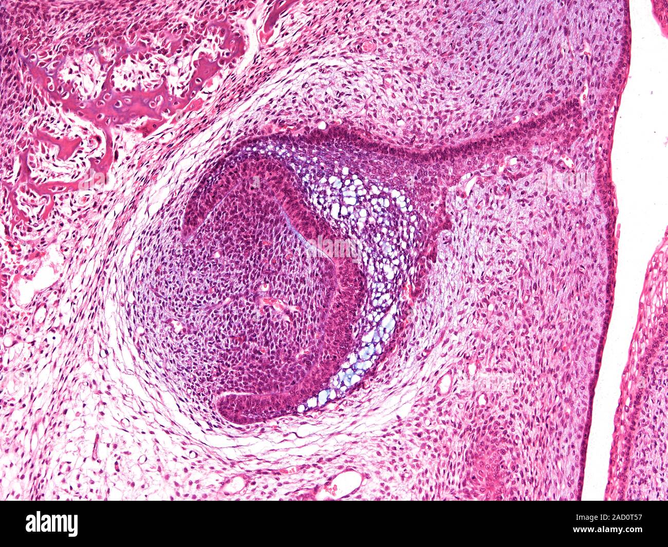 Light microscopy of a early phase of tooth development in the fetus ...