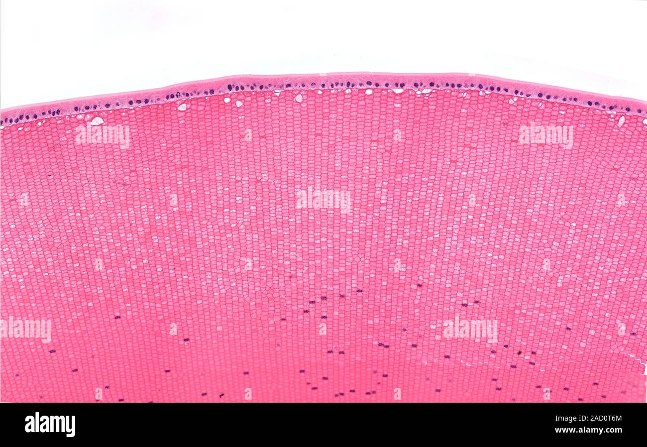 Light microscopy of fibres in the lens of the eye. The lens is covered