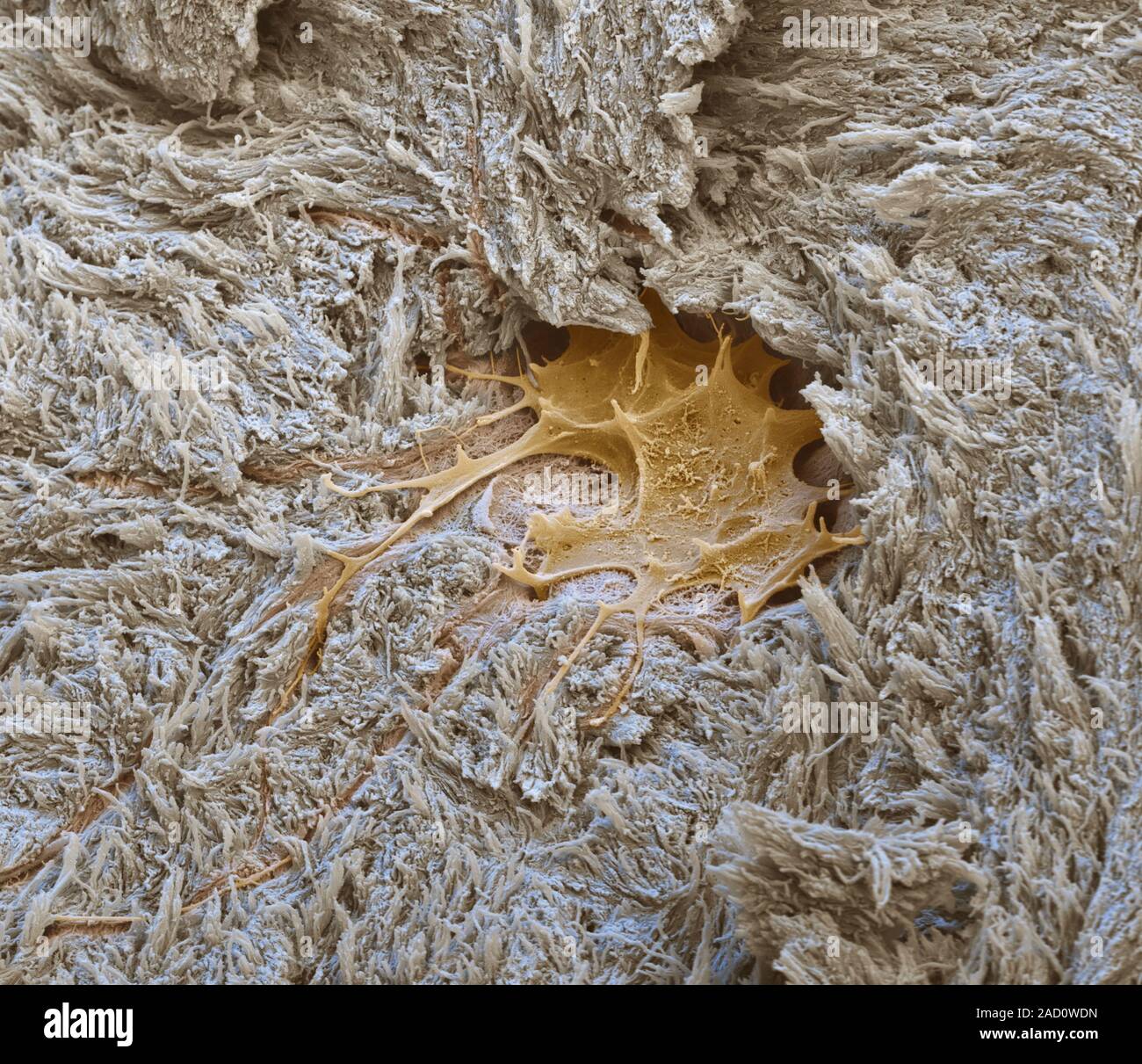 Osteocyte bone cell. Coloured scanning electron micrograph (SEM) of an