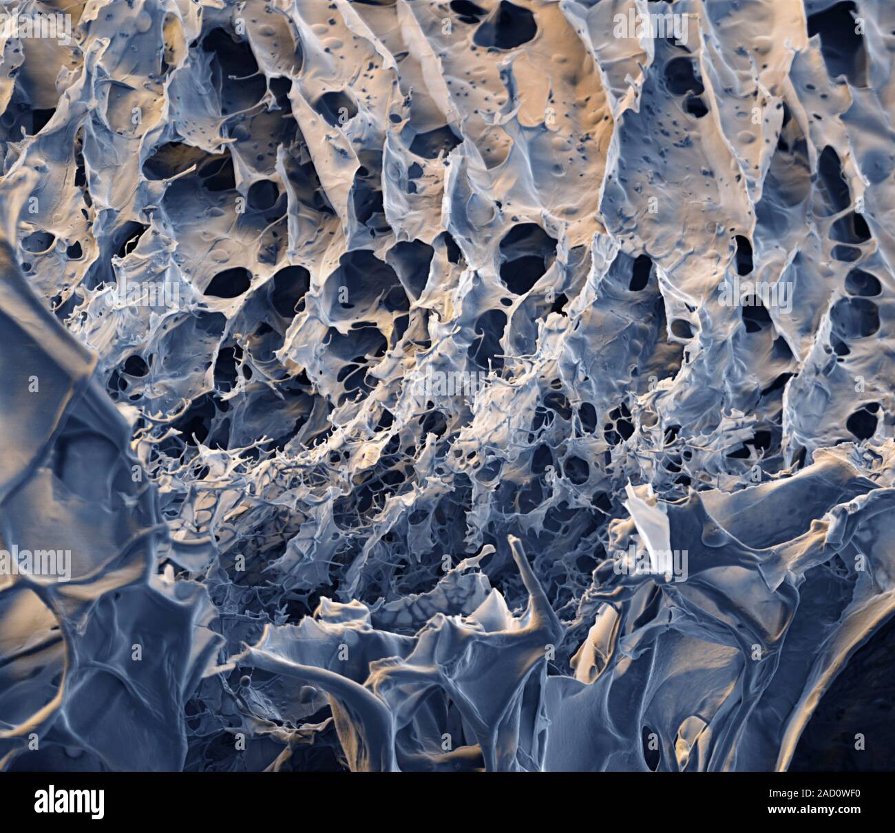 Spider silk from bacteria. Coloured scanning electron micrograph (SEM) of spider silk produced