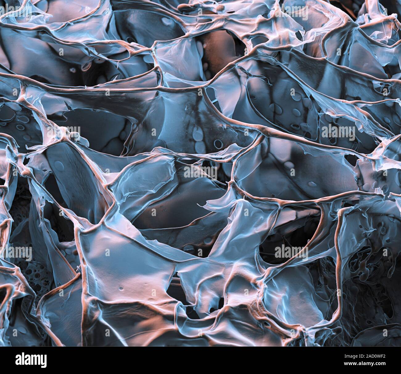 Spider silk from bacteria. Coloured scanning electron micrograph (SEM