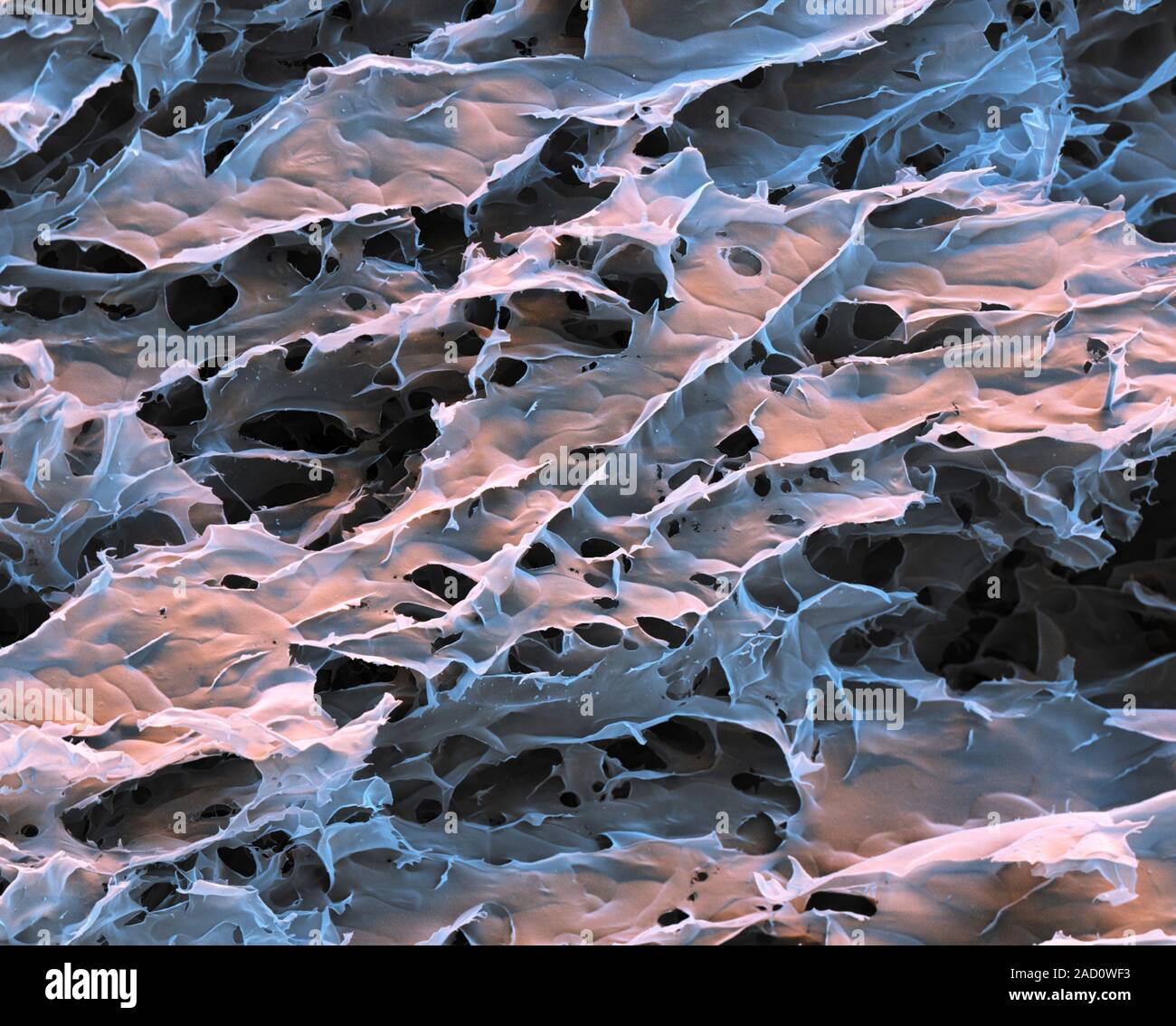 Spider silk from bacteria. Coloured scanning electron micrograph (SEM) of spider silk produced