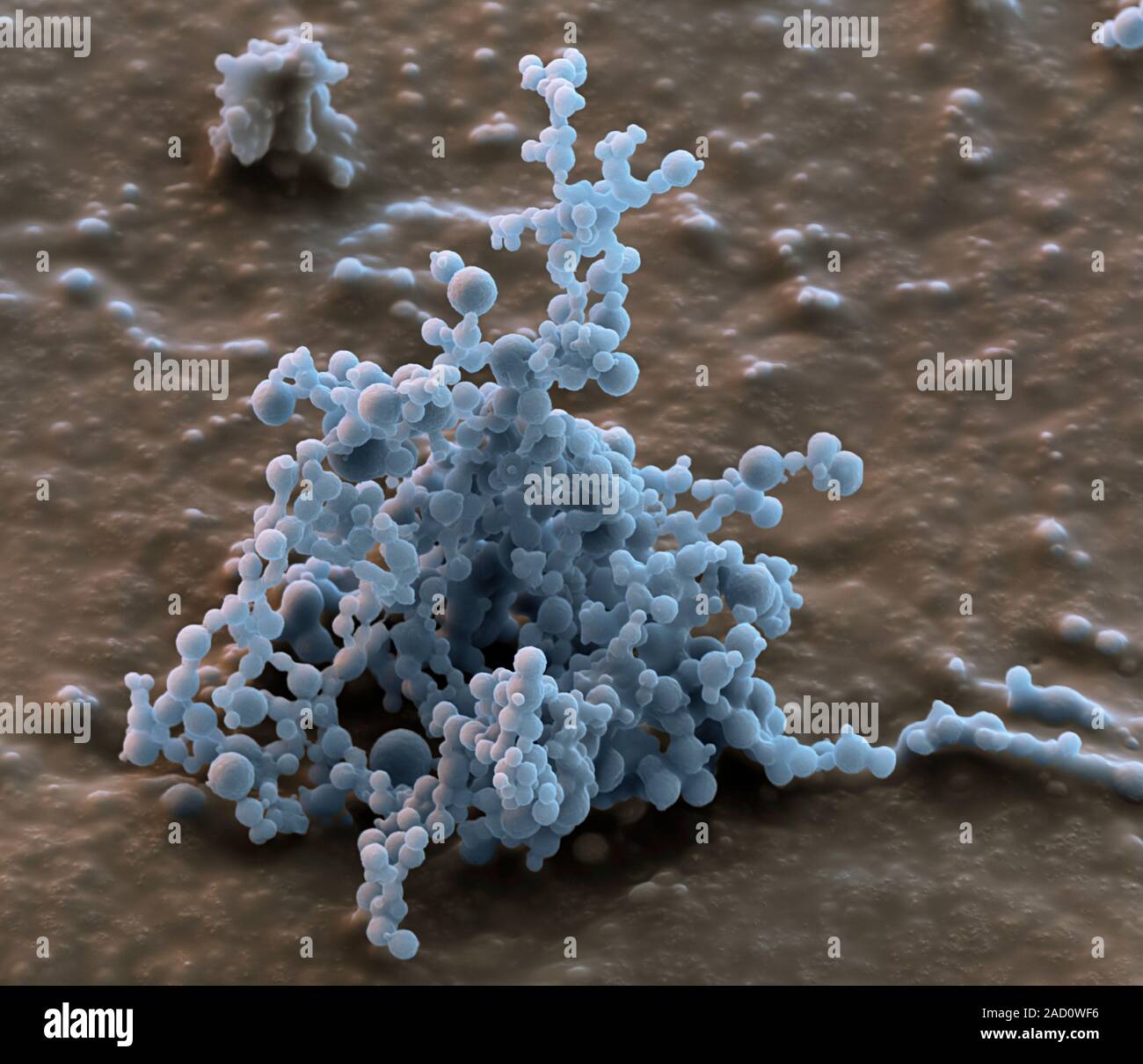 Spider silk from bacteria. Coloured scanning electron micrograph (SEM