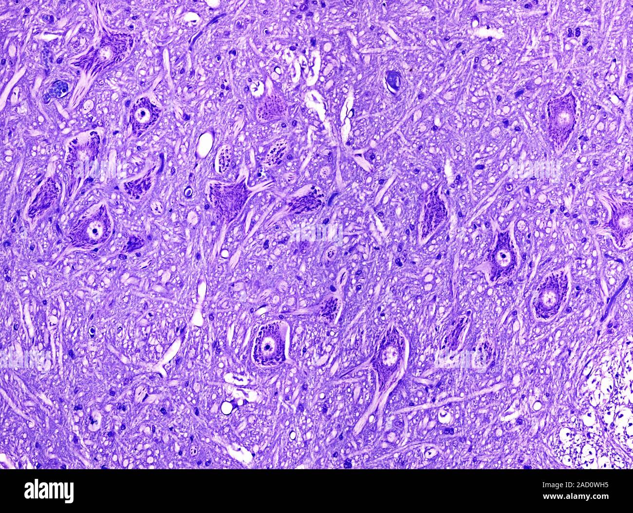 Light microscopy of motor neurons in spinal cord grey matter. The cell ...
