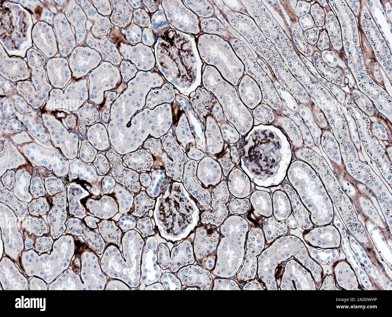 Light microscopy of the kidney showing several glomeruli and many renal