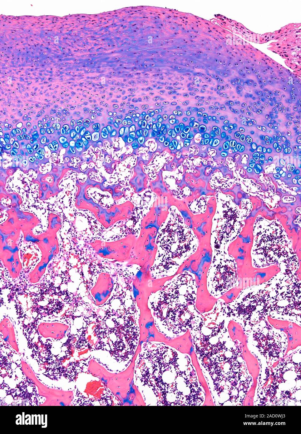 Light microscopy of developing bone. The top layer (purple, pink) is