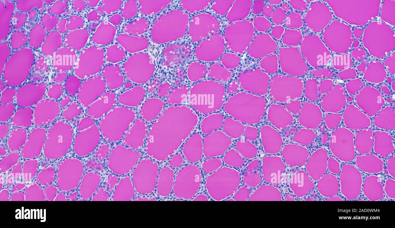 Light microscopy of thyroid gland. The thyroid consists of thousands of