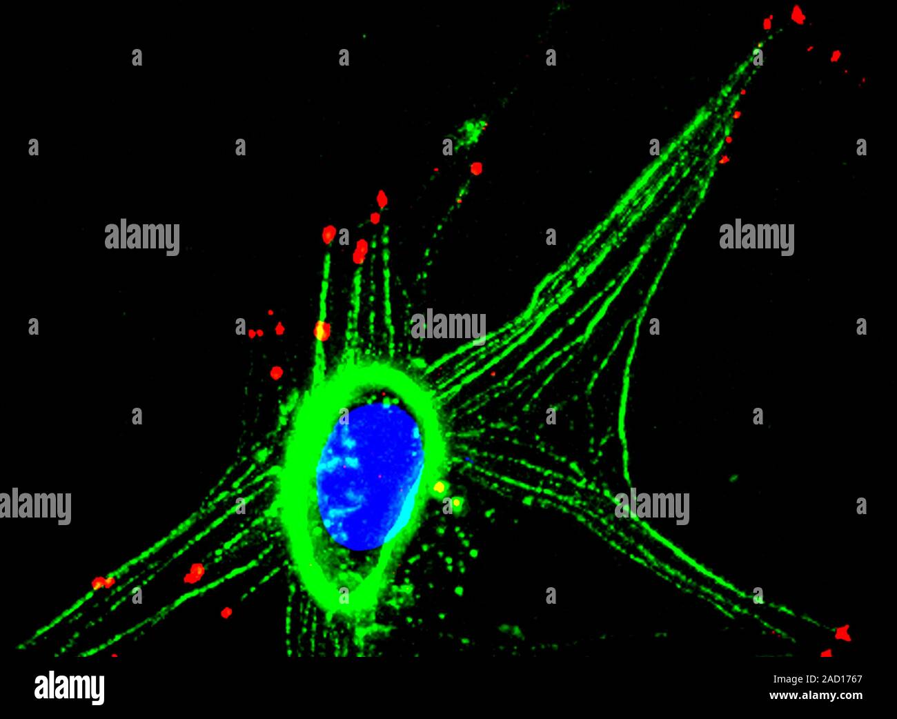 Astrocyte Nerve Cell Fluorescent Deconvolution Light Micrograph Of A
