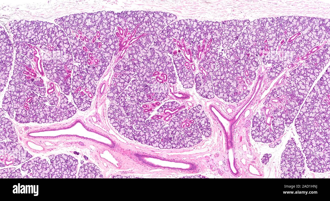 Light microscopy of a salivary gland characterized by clusters or