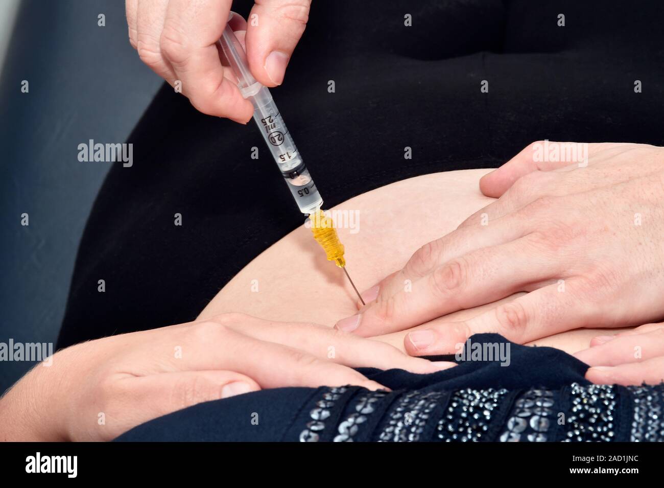 Gastric band adjustment injection. Patient being shown how to adjust ...