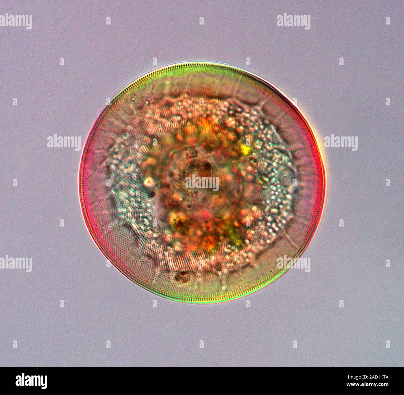 Shelled amoeba. Polarised light micrograph of an Arcella sp. testate ...