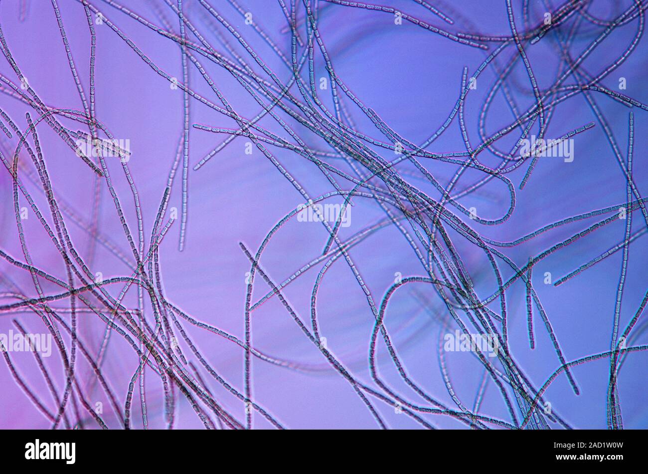 Oscillatoria cyanobacteria. Polarised light micrograph of Oscillatoria