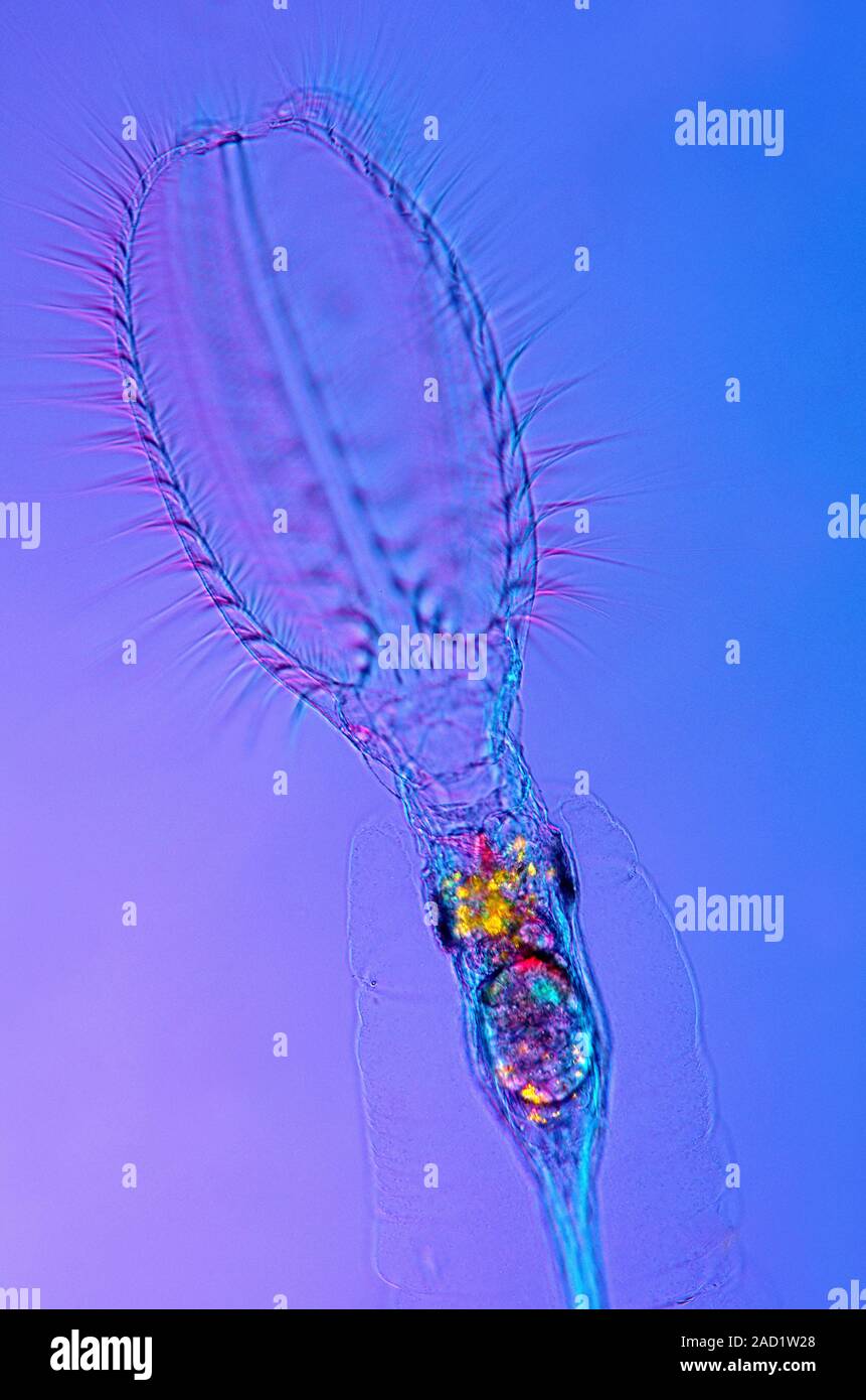 Stephanoceros rotifer. Polarised light micrograph of a Stephanoceros