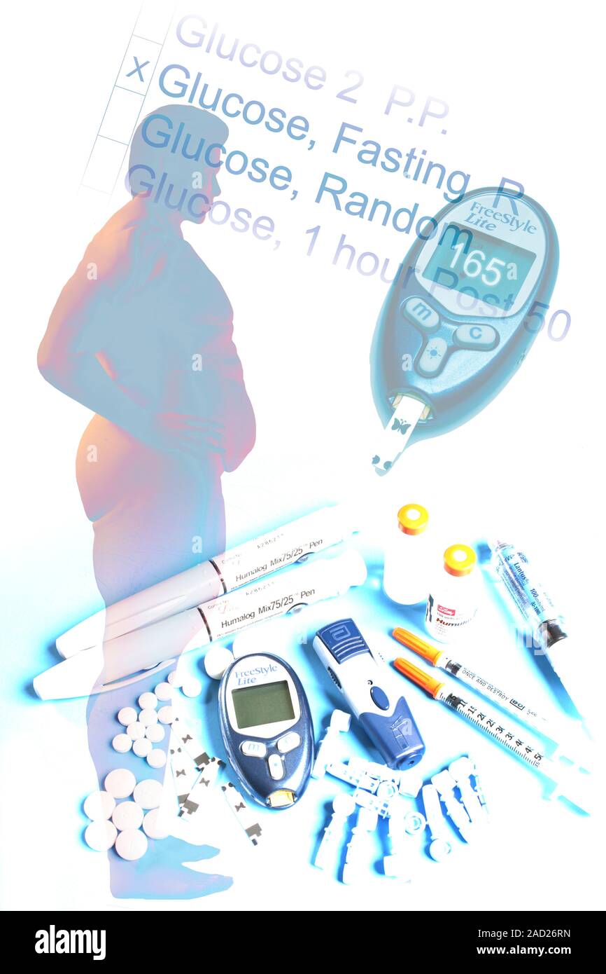 Illustration of an obese male figure. Obesity can lead to health ...