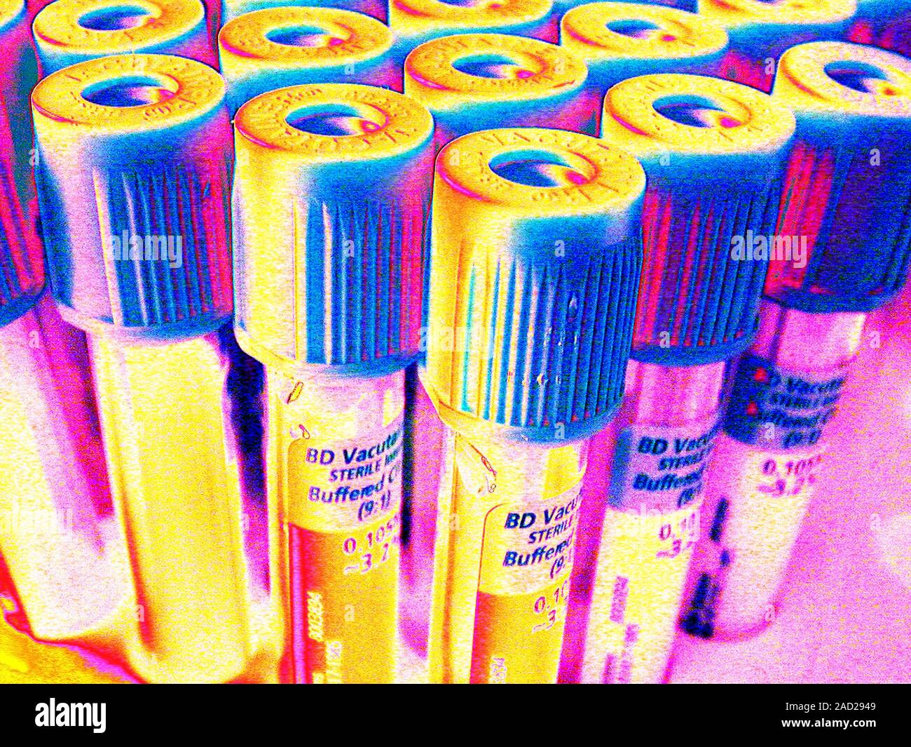 Blood vials. Abstract coloured image of vacutainers, specialised