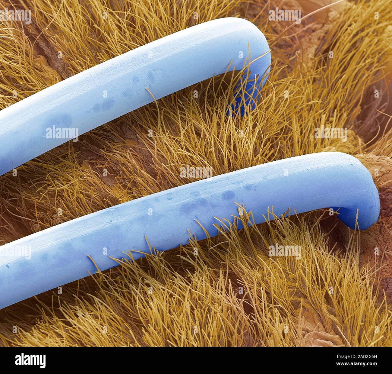 Surgical staples. Coloured scanning electron micrograph (SEM) of surgical staple in a repair of